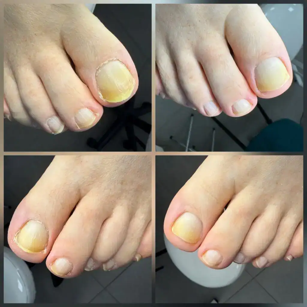 Качественное восстановление ногтей Екатерина Силина.